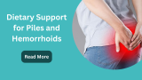 Dietary Support for Piles and Hemorrhoids