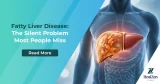 Part 1: Fatty Liver Disease: The Silent Problem Most People Miss