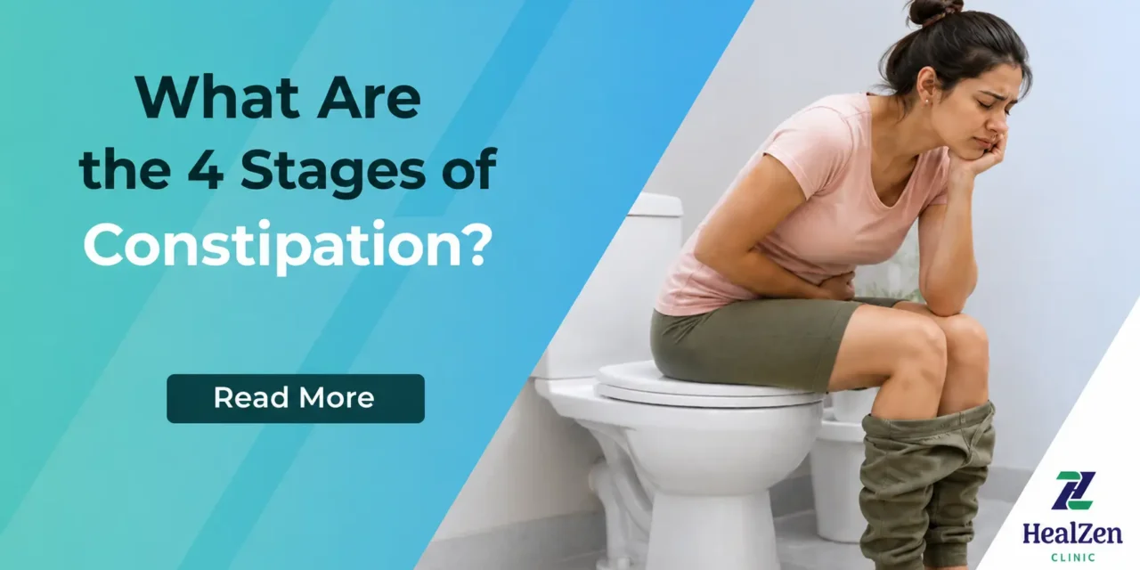 What Are the 4 Stages of Constipation?
