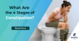 What Are the 4 Stages of Constipation?