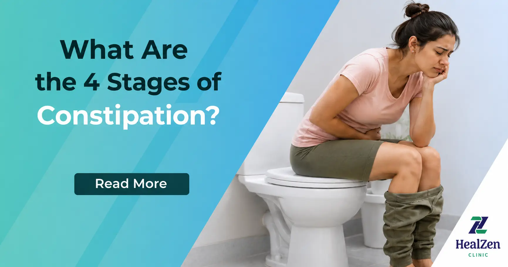 What Are the 4 Stages of Constipation_ What Are the 4 Stages of Constipation?